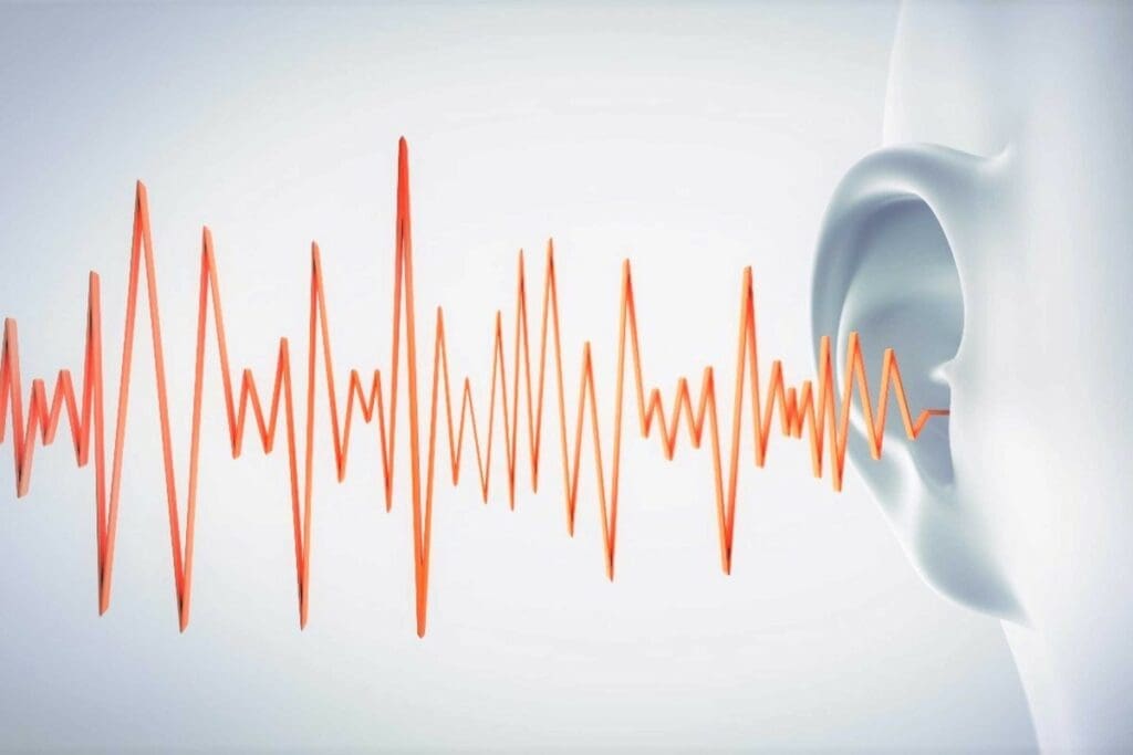 what are acoustics