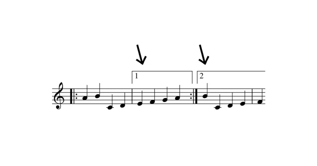 Volta Brackets